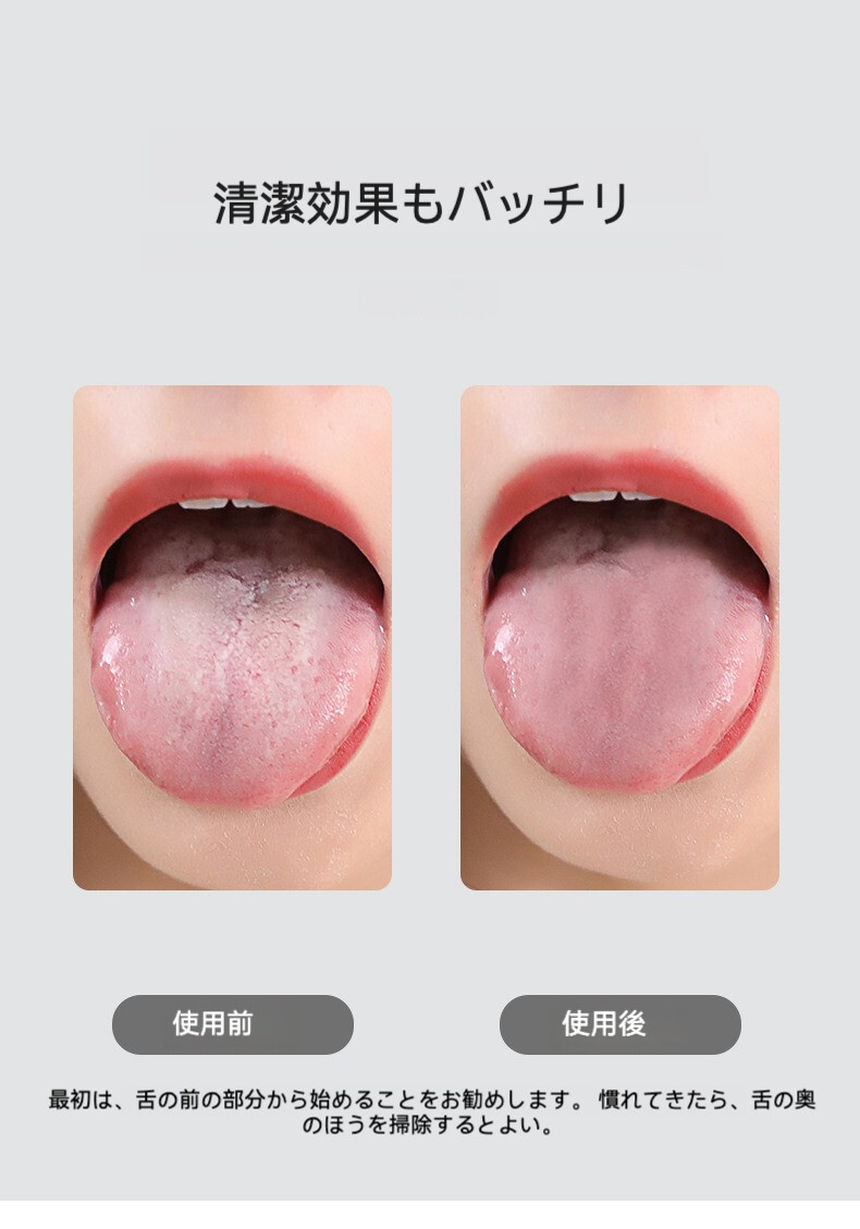 舌苔クリーナー｜口臭予防・大人用・舌苔除去・舌ブラシ・舌クリーナー・舌磨きブラシ・舌苔スプーン・ベロブラシ|undefined