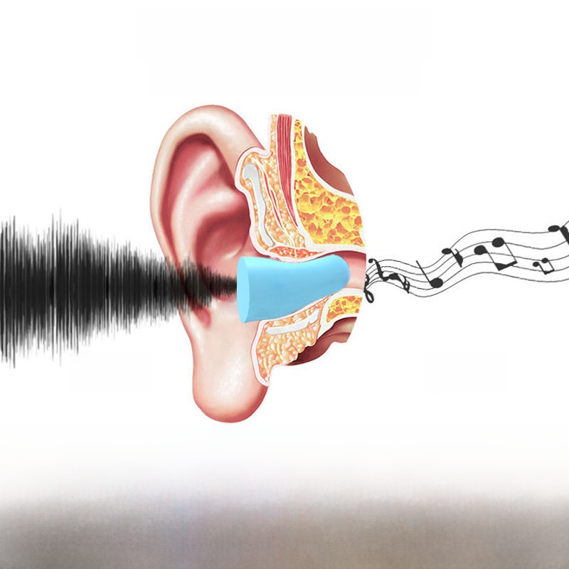 カプセルイヤープラグ・防音・睡眠・学習用・超遮音・騒音対策・いびき防止・快適な睡眠・仕事用|undefined