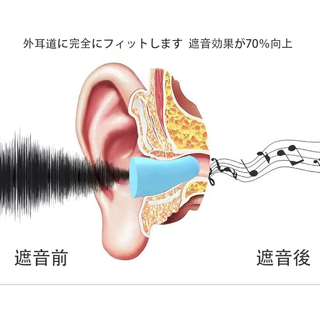 睡眠用耳栓|耳栓・安眠・防音・高性能・・飛行機仕事・勉強・キャンプ・瞑想・ノイズキャンセル・水洗い可能・繰り返し使用可能 |undefined