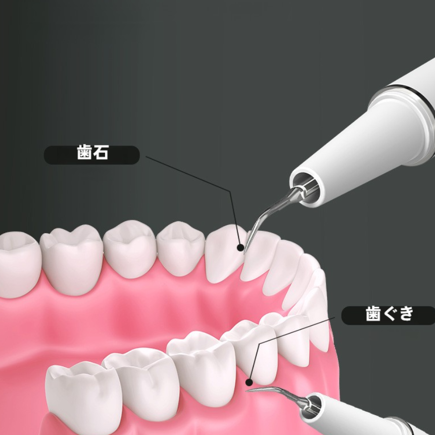 口腔洗浄器｜超音波歯クリーナー・電動・歯磨き器・歯石除去・煙草の汚れ・家庭用・歯垢清掃・段階|undefined
