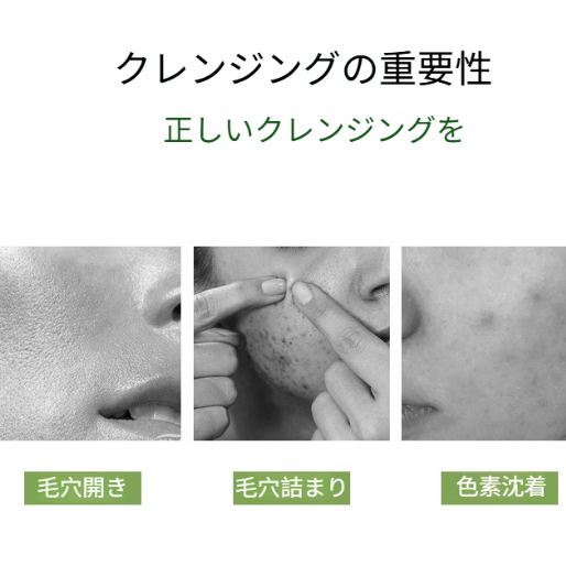 Kiss Beauty クレンジングバーム｜アボカドオイル配合・メイク落とし・毛穴汚れ除去・やさしい・しっとり・つるつる|undefined