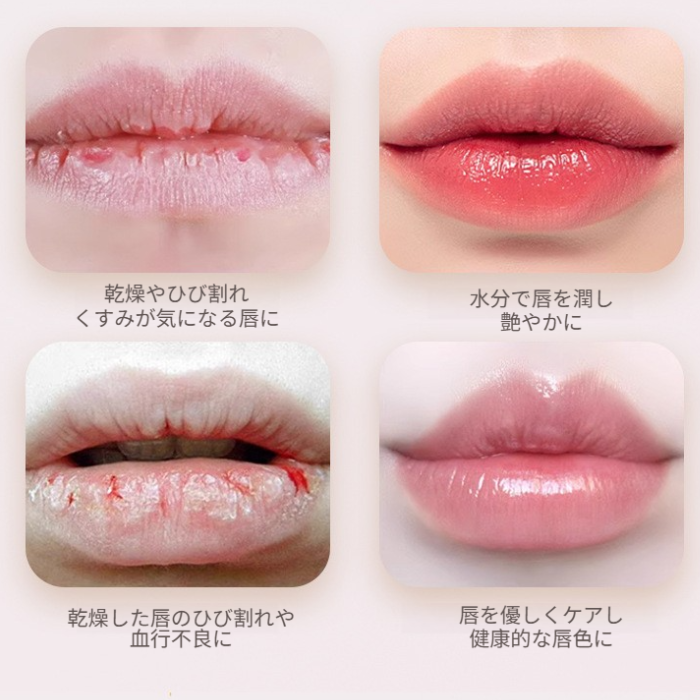 VMR リップクリーム｜金箔入り・透明・変色・保湿・学生向け・唇の荒れを防ぐ・血色感アップ・唇の縦じわカバー|undefined